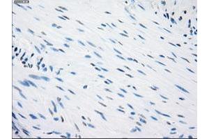 Image no. 1 for anti-Fc Fragment of IgG, Low Affinity IIa, Receptor (CD32) (FCGR2A) antibody (ABIN1497263)