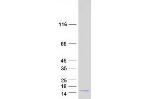 Validation with Western Blot
