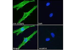 ABIN570824 Immunofluorescence analysis of paraformaldehyde fixed HeLa cells, permeabilized with 0.