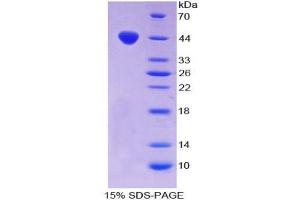 SDS-PAGE analysis of Mouse Chemerin Protein.