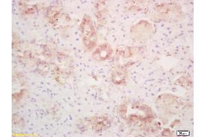 Formalin-fixed and paraffin embedded rat thyroid labeled with Rabbit Anti PLRP1/PNLIPRP1 Polyclonal Antibody, Unconjugated (ABIN718826) at 1:200 followed by conjugation to the secondary antibody and DAB staining (PNLIPRP1 anticorps  (AA 375-467))