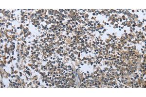 Immunohistochemistry of paraffin-embedded Human tonsil tissue using PRL Polyclonal Antibody at dilution 1:30 (Prolactin anticorps)