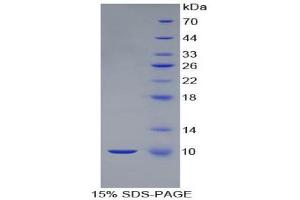 SDS-PAGE (SDS) image for S100 Calcium Binding Protein B (S100B) (AA 1-92) protein (His tag) (ABIN1080767) (S100B Protein (AA 1-92) (His tag))