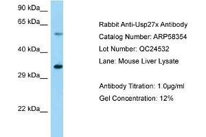 Western Blotting (WB) image for anti-Ubiquitin Specific Peptidase 27, X-Linked (USP27X) (Middle Region) antibody (ABIN2787648) (USP27X anticorps  (Middle Region))