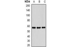 Western blot analysis of PDE1B expression in THP1 (A), mouse brain (B), mouse spleen (C) whole cell lysates. (PDE1B anticorps)