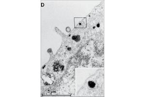 Electron microscopic image of internalized EGF-R/antibody-complexes in A431 cells.