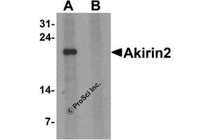 Western Blotting (WB) image for anti-Akirin 2 (AKIRIN2) (Middle Region 1) antibody (ABIN1031185) (AKIRIN2 anticorps  (Middle Region 1))