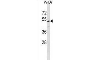 Western Blotting (WB) image for anti-MLF1 Interacting Protein (MLF1IP) antibody (ABIN2999451)