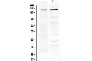 Western Blotting (WB) image for anti-ATP-Binding Cassette, Sub-Family B (MDR/TAP), Member 1 (ABCB1) antibody (ABIN5693064) (ABCB1 anticorps)