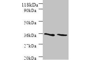Western blot All lanes: SNX20 antibody at 2 μg/mL Lane 1: Mouse spleen tissue Lane 2: Mouse skeletal muscle tissue Secondary Goat polyclonal to rabbit IgG at 1/10000 dilution Predicted band size: 37, 18, 15, 12 kDa Observed band size: 37 kDa