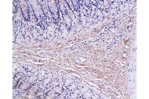 Immunohistochemistry (Paraffin-embedded Sections) (IHC (p)) image for anti-Collagen, Type I (COL1) (AA 1321-1400) antibody (ABIN670386)