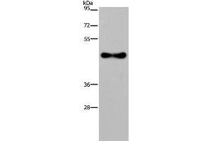 Western Blot analysis of Human fetal brain tissue using FADS1 Polyclonal Antibody at dilution of 1:300 (FADS1 anticorps)