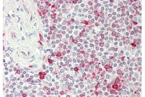 Rabbit Anti-PSAT1 antibody  Formalin Fixed Paraffin Embedded Tissue: Human Spleen Primary antibody Concentration: 1:100 Secondary Antibody: Donkey anti-Rabbit-Cy3 Secondary Antibody Concentration: 1:200 Magnification: 20x Exposure Time: 0.