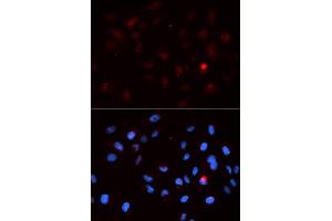 Immunofluorescence analysis of MCF7 cell using Phospho-CDK1-T14 antibody. (CDK1 anticorps  (pThr14))