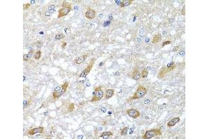 Immunohistochemistry of paraffin-embedded Rat brain using HSPA6 Polyclonal Antibody at dilution of 1:100 (40x lens).