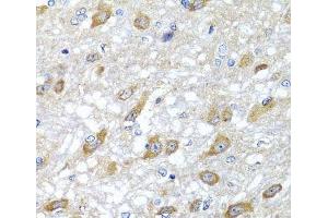 Immunohistochemistry of paraffin-embedded Rat brain using HSPA6 Polyclonal Antibody at dilution of 1:100 (40x lens). (HSPA6 anticorps)