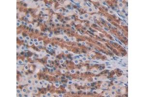Used in DAB staining on fromalin fixed paraffin- embedded stomach tissue