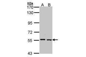 Image no. 1 for anti-Catalase (CAT) (AA 89-311) antibody (ABIN467582) (Catalase anticorps  (AA 89-311))