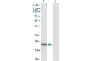 Western Blot analysis of KISS1 expression in transfected 293T cell line by KISS1 monoclonal antibody (M05), clone 1F7. (KISS1 anticorps  (AA 46-145))