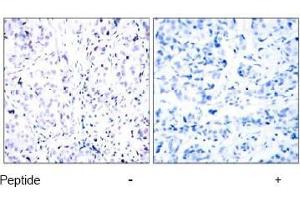 Image no. 1 for anti-Retinoblastoma 1 (RB1) (Ser807) antibody (ABIN197282) (Retinoblastoma 1 anticorps  (Ser807))