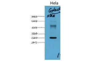 Western Blot (WB) analysis of HeLa, diluted at 1:3000. (Galectin 3 anticorps)