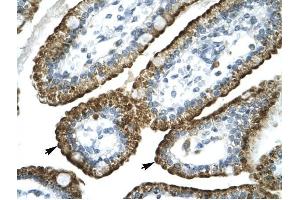 GABRP antibody was used for immunohistochemistry at a concentration of 4-8 ug/ml to stain Epithelial cells of intestinal villus (lndicated with Arrows) in Human Intestine.