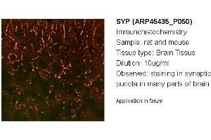 Image no. 2 for anti-Synaptophysin (SYP) (N-Term) antibody (ABIN502628) (Synaptophysin anticorps  (N-Term))