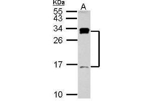 WB Image Sample (30 ug of whole cell lysate) A: Raji 15% SDS PAGE antibody diluted at 1:1000 (C1D anticorps)