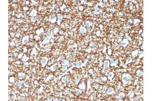 Formalin-fixed, paraffin-embedded human Brain stained with ARF1 Mouse Monoclonal Antibody (ARF1/2117). (ARF1 anticorps)