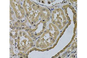 Immunohistochemistry of paraffin-embedded Human kidney using LCP1 Polyclonal Antibody at dilution of 1:100 (40x lens). (LCP1 anticorps)