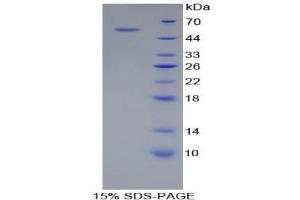 SDS-PAGE analysis of Pig Adiponectin Protein. (ADIPOQ Protéine)