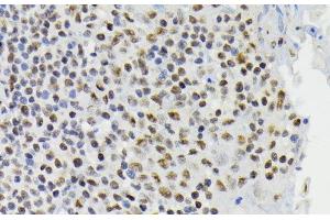 Immunohistochemistry of paraffin-embedded Human tonsil using Phospho-CREB1(S133) Polyclonal Antibody at dilution of 1:200 (40x lens). (CREB1 anticorps  (pSer133))