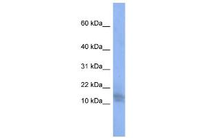 WB Suggested Anti-BRWD1 Antibody Titration:  0.
