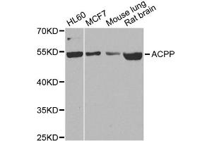 Western blot analysis of extracts of various cell lines, using ACPP antibody. (ACPP anticorps)