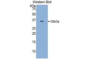 Western Blotting (WB) image for anti-Insulin Receptor (INSR) (AA 1024-1298) antibody (ABIN1078206) (Insulin Receptor anticorps  (AA 1024-1298))