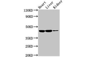 Western Blot Positive WB detected in: Rat heart tissue, Rat liver tissue, Rat kidney tissue All lanes: IL10RB antibody at 2 μg/mL Secondary Goat polyclonal to rabbit IgG at 1/50000 dilution Predicted band size: 37 kDa Observed band size: 45 kDa (IL1R2 anticorps  (AA 79-219))