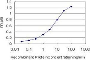 Detection limit for recombinant GST tagged RORB is approximately 0. (RORB anticorps  (AA 136-224))