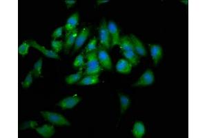 Immunofluorescence staining of Hela cells with ABIN7155501 at 1:133, counter-stained with DAPI. (WHSC1 anticorps  (AA 1-44))