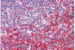 Human Spleen: Formalin-Fixed, Paraffin-Embedded (FFPE) (ATG9B anticorps  (C-Term))