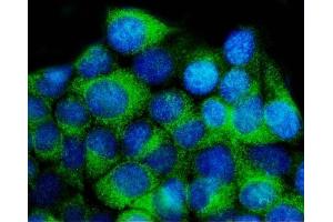IF analysis of YWHAE using anti-YWHAE antibody (ABIN7599166).