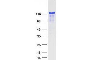 Validation with Western Blot
