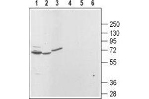 Western blot analysis of rat brain (lanes 1 and 4), kidney (lanes 2 and 5) and pancreas (lanes 3 and 6): - 1,2,3. (Mucolipin 3 anticorps  (Cytoplasmic Domain, Intracellular))
