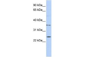 IQCF1 antibody used at 1 ug/ml to detect target protein. (IQCF1 anticorps  (Middle Region))