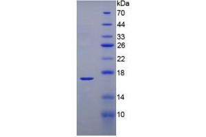 SDS-PAGE analysis of Mouse Transthyretin Protein. (TTR Protéine)