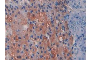 DAB staining on IHC-P; Samples: Rat Adrenal gland Tissue (ADAMTS1 anticorps  (AA 854-967))