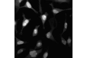 Immunofluorescent staining of HeLa (ATCC CCL-2) cells.