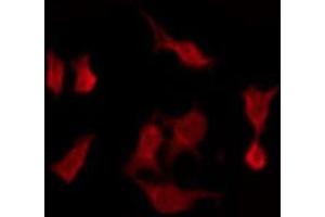 ABIN6275454 staining HeLa by IF/ICC. (RASL10A anticorps  (Internal Region))