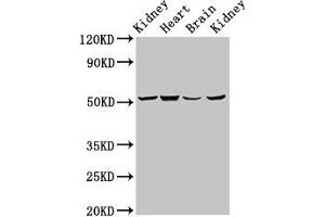 Western Blot Positive WB detected in: Rat kidney tissue, Mouse heart tissue, Mouse brain tissue, Mouse kidney tissue All lanes: NDUFS2 antibody at 6. (NDUFS2 anticorps  (AA 297-427))