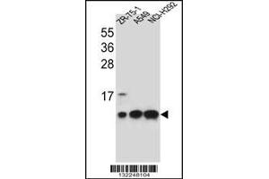 Western blot analysis in ZR-75-1,A549,NCI-H292 cell line lysates (35ug/lane). (COX6B1 anticorps  (C-Term))