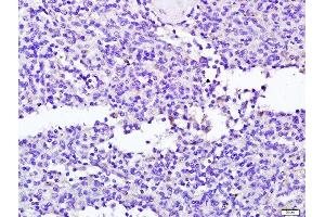 Paraformaldehyde-fixed, paraffin embedded human spleen tissue, Antigen retrieval by boiling in sodium citrate buffer(pH6) for 15min, Block endogenous peroxidase by 3% hydrogen peroxide for 30 minutes, Blocking buffer (normal goat serum) at 37°C for 20min, Antibody incubation with Rabbit Anti-NCR2 Polyclonal Antibody, Unconjugated  at 1:400 overnight at 4°C, followed by a conjugated secondary and DAB staining